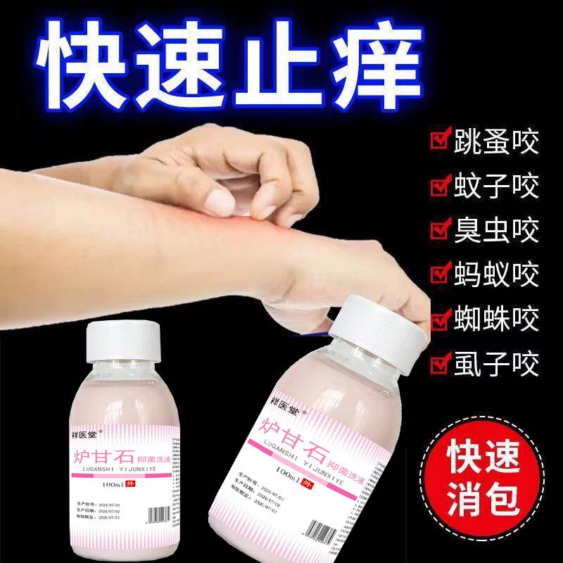 被蚊子臭虫毒蚂蚁咬螨虫跳蚤叮咬消红肿皮肤瘙痒过敏药炉甘石抑菌