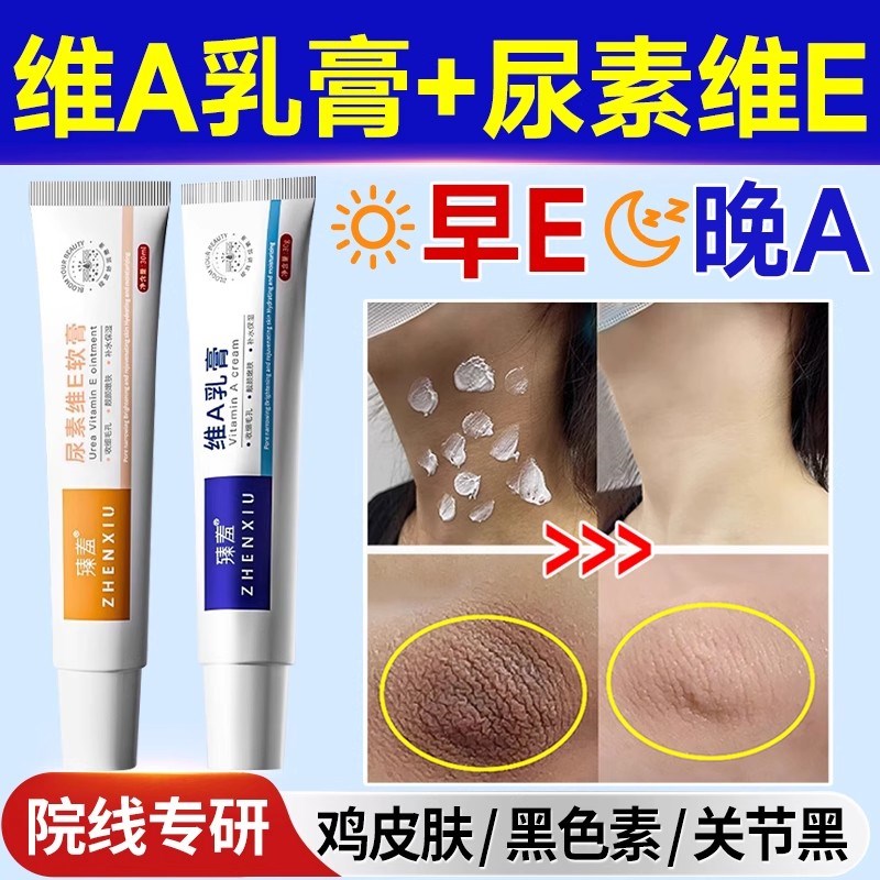 维a乳胶膏和尿素维e乳软膏去黑色素暗沉淀去鸡皮肤毛周囊角化质酸