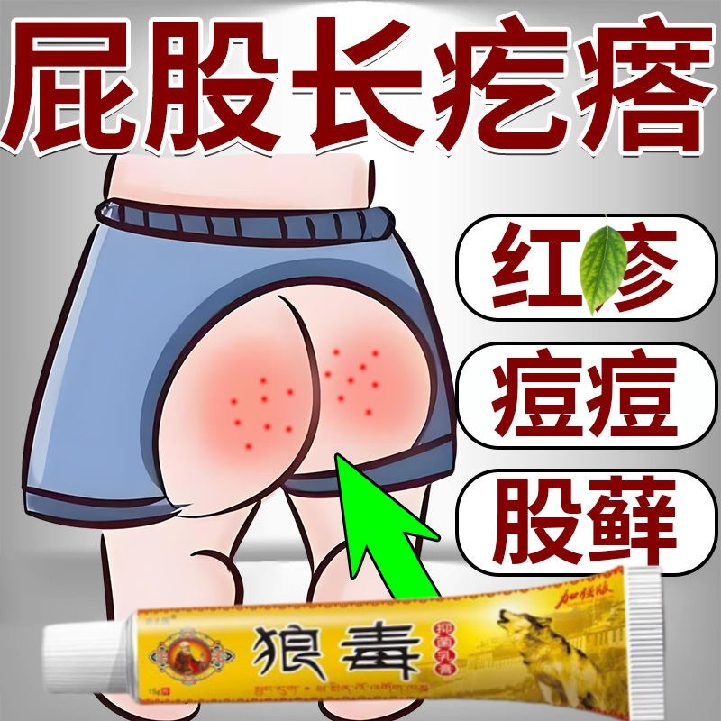 火疖子拔毒膏贴硬疙瘩浓包红肿痘痘坐板疮拔脓膏硬块毛囊吸脓神器