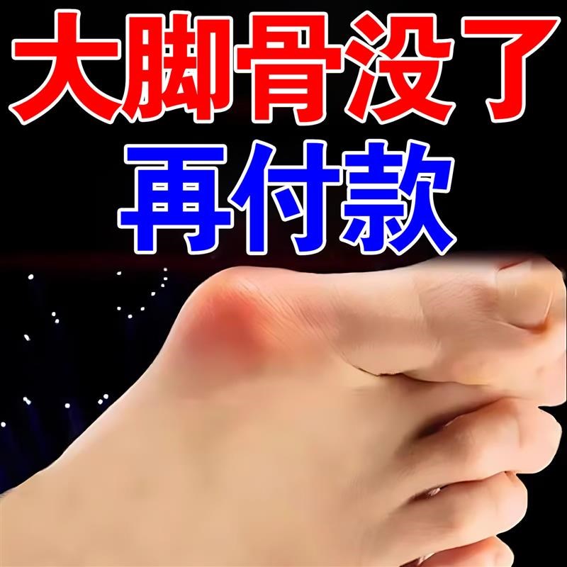 拇指外翻贴脚趾重叠防磨大脚骨外翻矫正专用膏药贴
