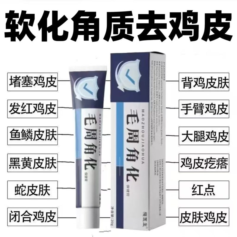 毛周角化症皮肤膏胳膊腿部疙瘩软化角质问题去鱼鳞鸡皮神器
