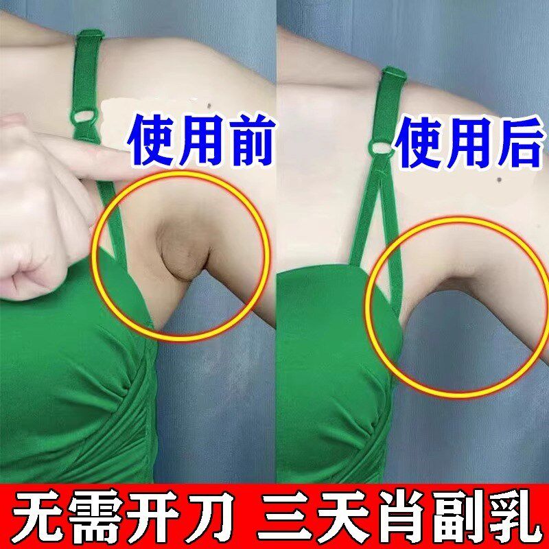 副乳贴去副e乳神器【最慢3天收副乳】腋下淋巴疏通膏药贴
