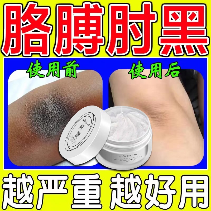肘膝美颜净化素膏胳膊肘黑膝盖皮肤黑色素沉淀去除肘关节去黑神器