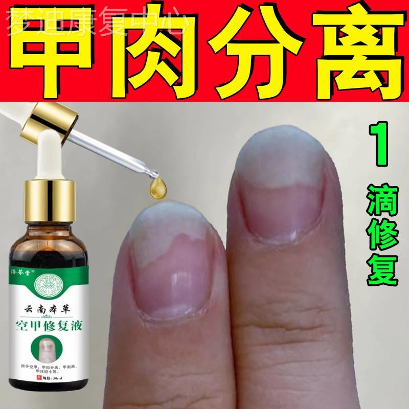 空指甲肉甲分离指甲受损修复凹凸不平开裂分层竖纹甲床增长营养油