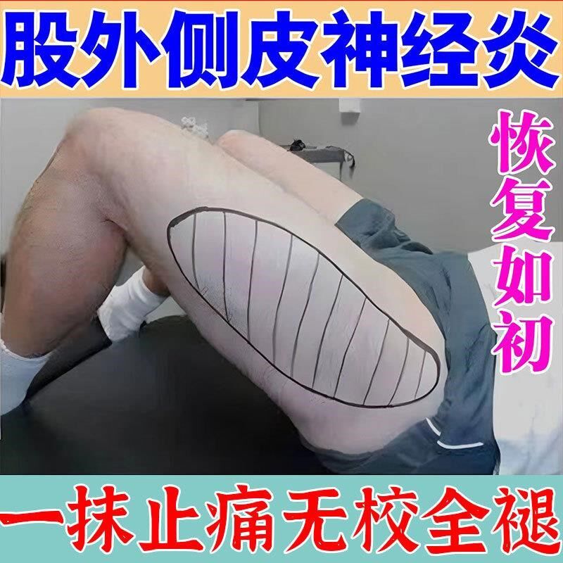 股外侧皮神经炎走不瞭路异常性股痛大腿外侧疼针刺感蚁走感麻木痛