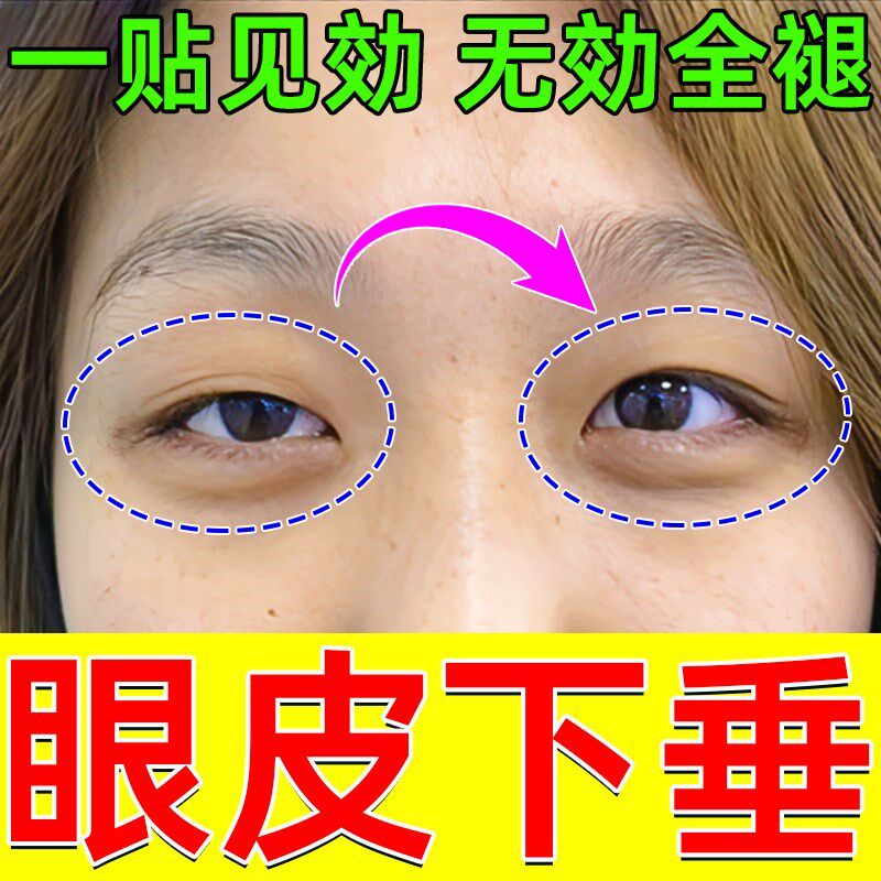眼皮下垂提拉眼贴防松弛撑上双眼皮贴非消肿眼泡中老年非专用神器