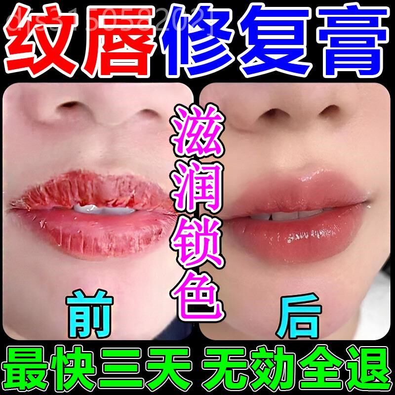 纹唇后的专用修复精华飘唇去肿固色锁色润唇膏亮唇不结痂修复液剂