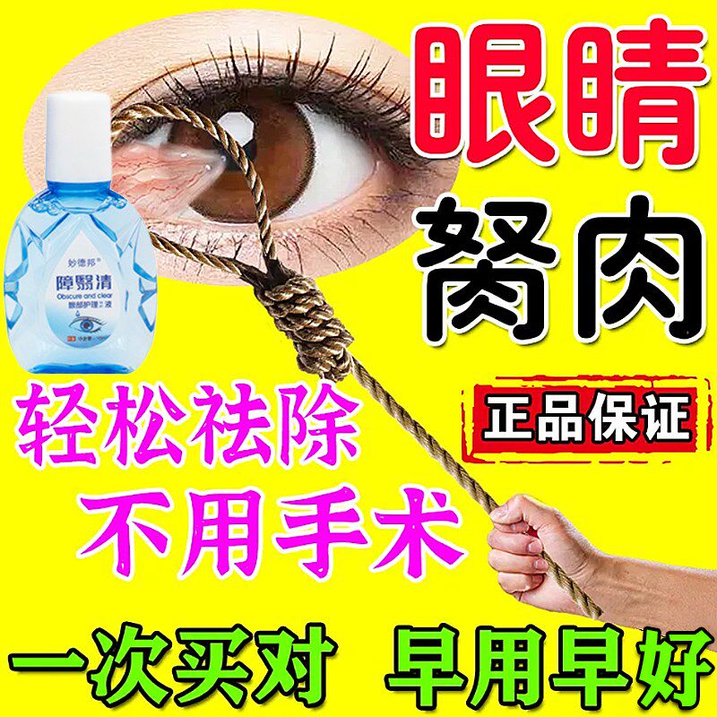 翼状眼睛胬肉滴眼液去除眼睛长胬肉眼角痒眼红干涩有异物感眼水