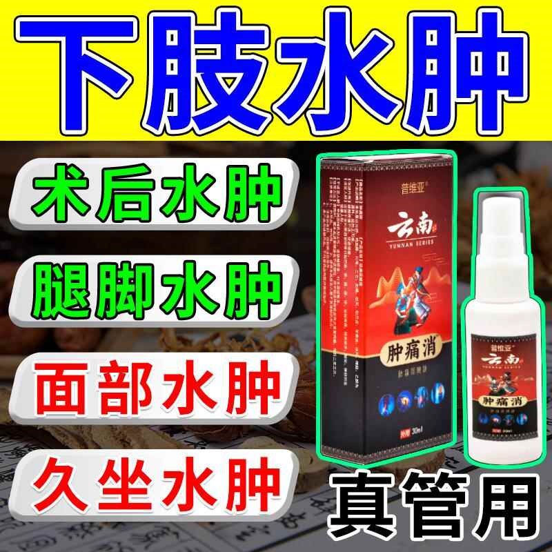 消脚肿水肿神器老人利尿排水肿消脸部小腿部下肢浮肿专用喷剂