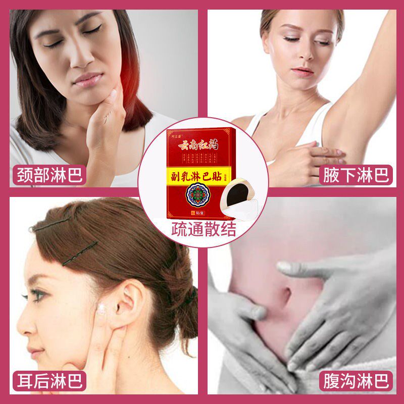 淋巴贴贴膏药肿大疏通耳后腋下颈部淋巴R膏节贴去副乳神器
