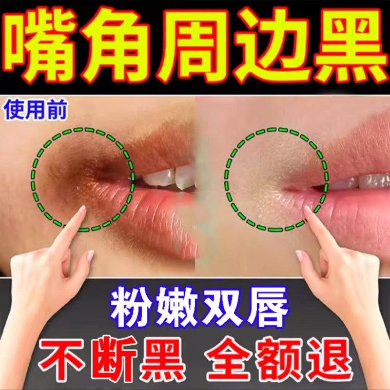 唇周黑改善嘴角暗沉去除黑色素嘴巴周边发黑暗沉唇部护理淡化唇色