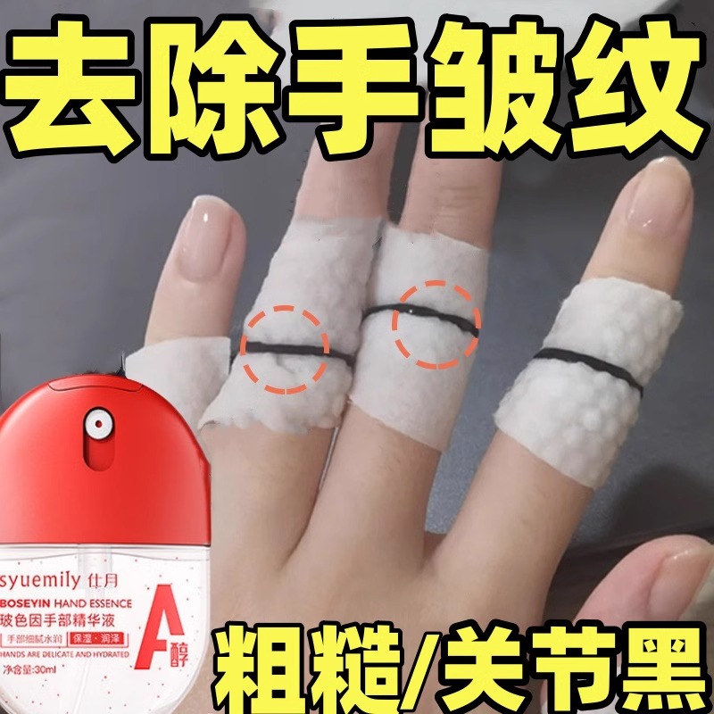 去手指关节皱纹黑祛除背干