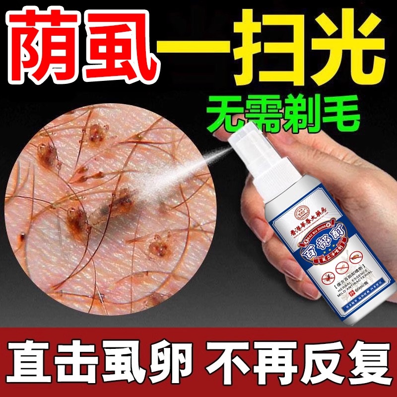 香港百部酊灭阴虱头虱药男女士私处虱子克星成人一扫光虱立净喷剂