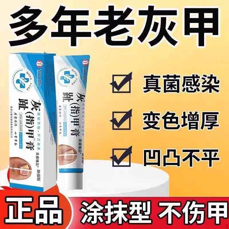 无痛脱甲膏灰指专用去趾快