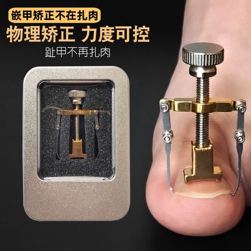 脚指甲盖矫正器甲沟炎神