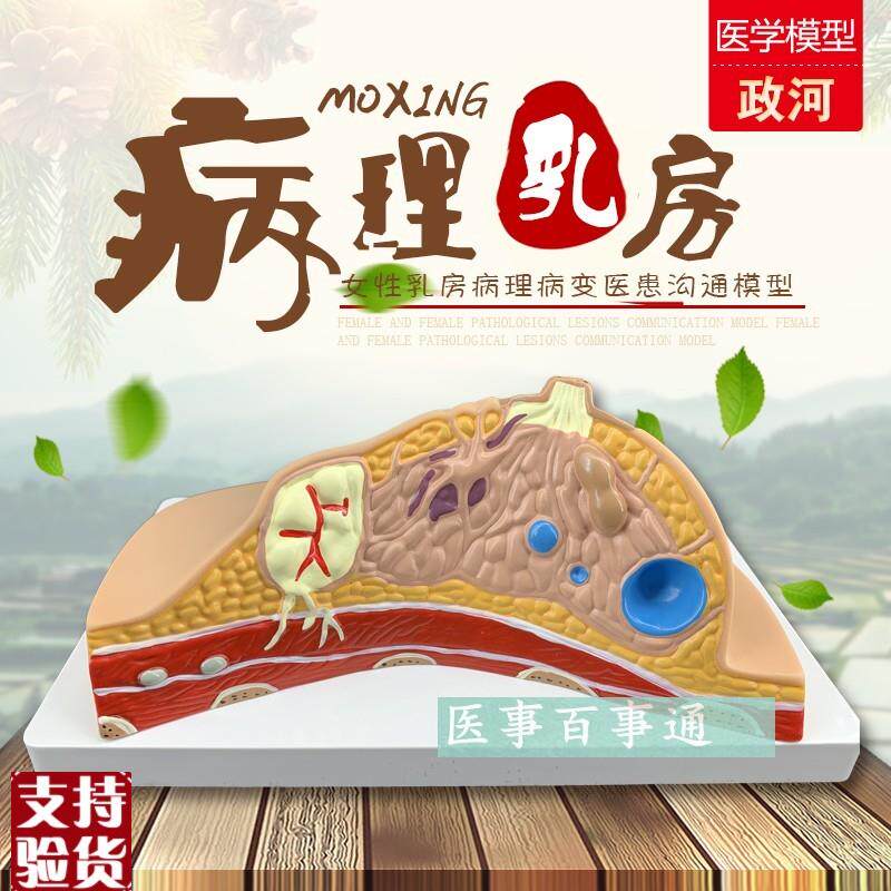 乳房模型解剖催乳培训健t康教育生理生物生殖哺乳期妇女用具器材