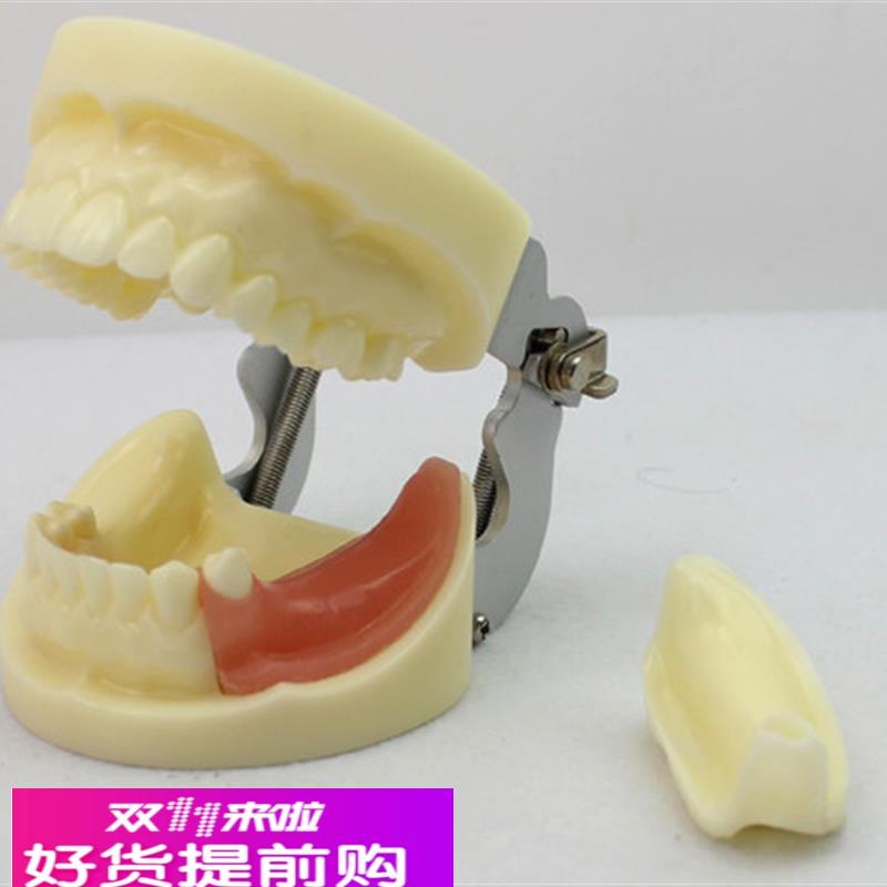 颐诺正品口腔模型口腔外科学教学模型牙颌牙医齿科种植体模型