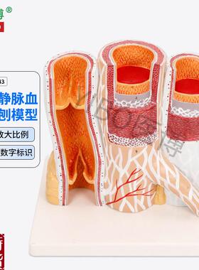 医博BIX-A3443动脉静脉血管解刨模型人I体血管解刨放大模型血管切