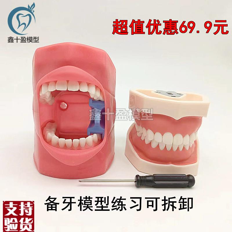 口腔备牙模型仿真牙齿模型练习A备牙粒离体牙口腔考试教学软牙龈