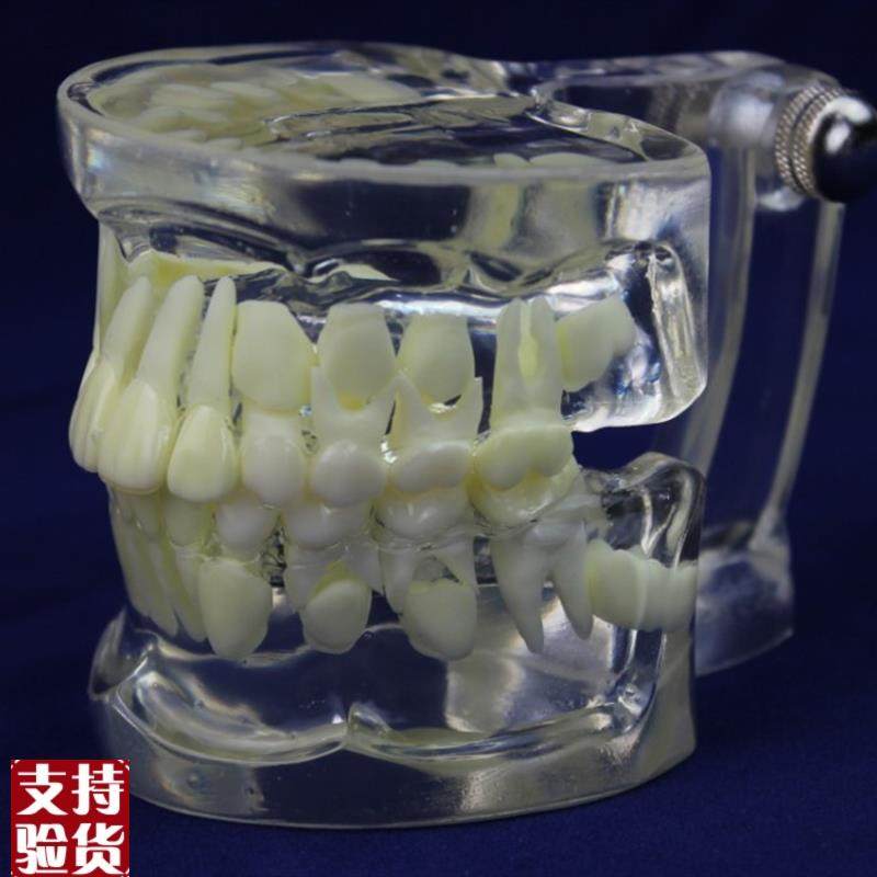 ENOVO颐诺全透明乳恒牙交替C模型儿童牙齿列发育指导刷牙模型,文具电教/文化用品/商务用品,教学标本/模型,淘宝优惠券,粉丝福利购,淘宝优惠卷