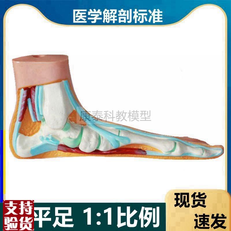 畸形脚模型高弓足爪行扁平脚足底解剖踝关节骨骼T肌肉康复功能模