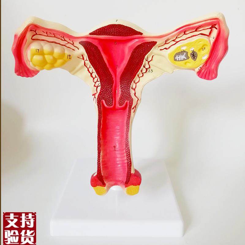 女性生殖器子宫模型阴道卵巢教学模具病理变O化产科普厂家直销包