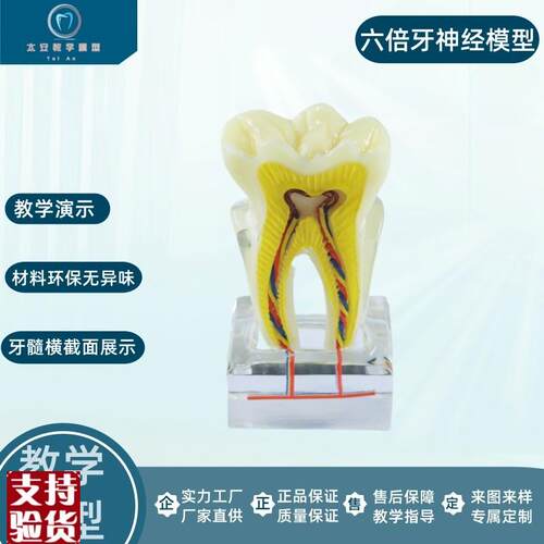 六倍龋齿模型牙齿模型牙科模型右E后牙组织分解模型六倍神经对比