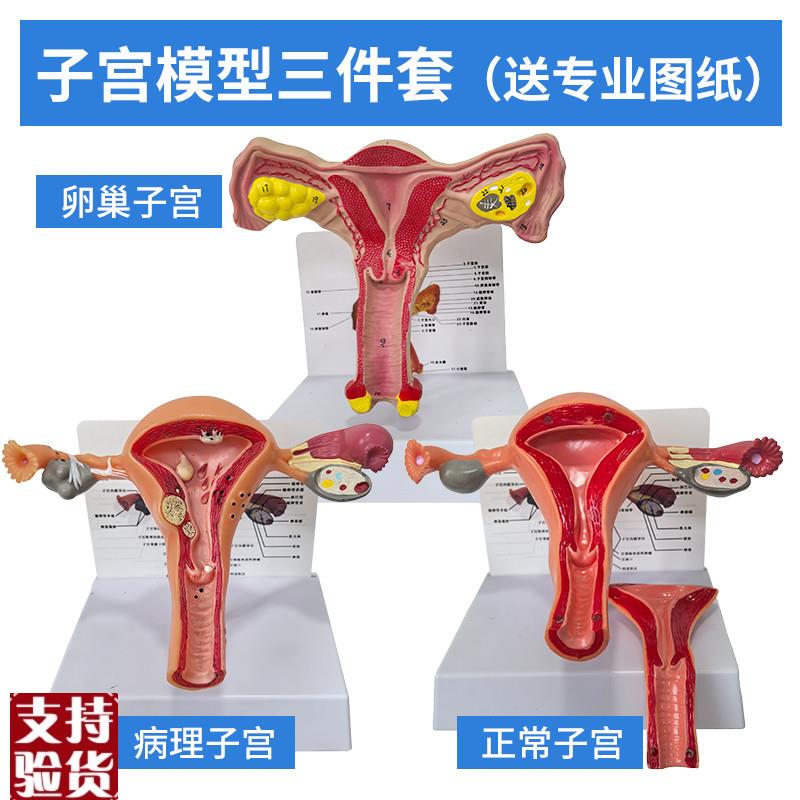 病理子宫模型病变子宫解剖卵巢模型妇科教具医R学人体女性生殖器