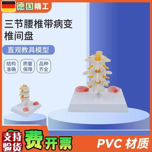 德国】PNT0131三节腰椎带病B变椎间盘病变椎间盘骨骼模型骨科疼痛