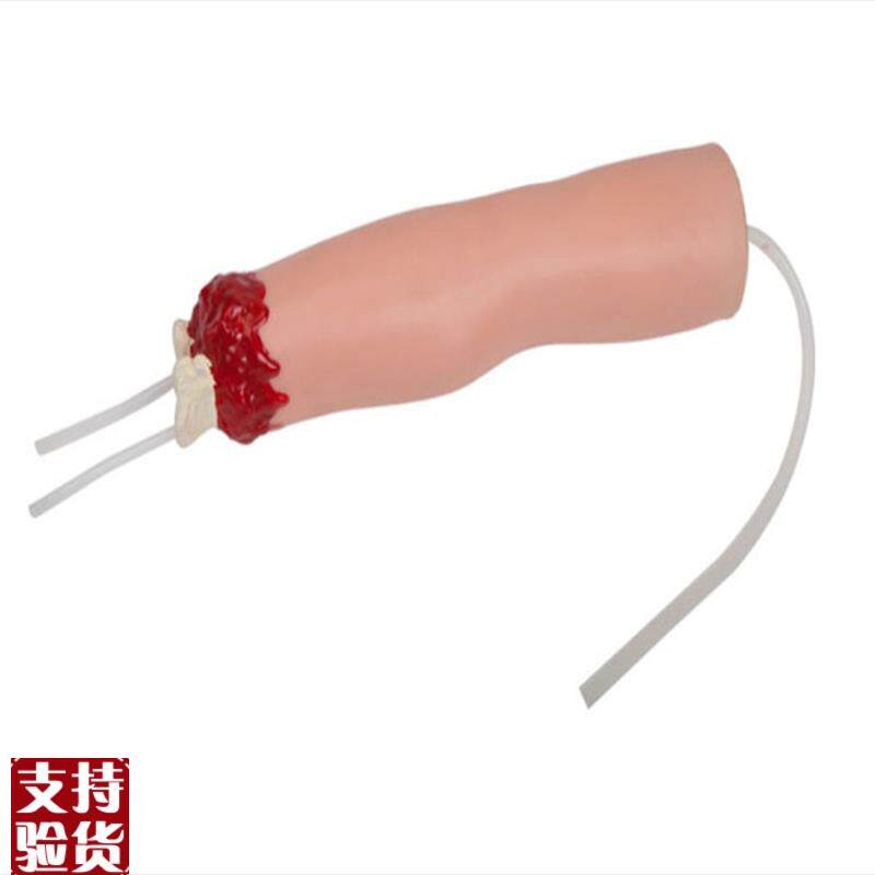 上肢外伤断肢止血模型