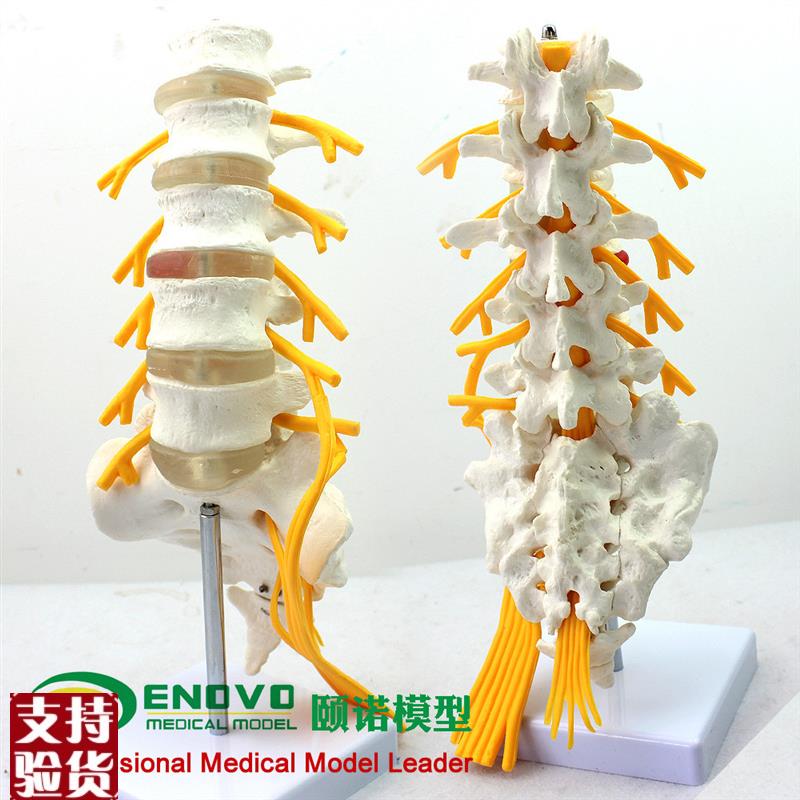 ENOVO颐诺医j学人体五节腰椎模型马尾神经坐骨神经模型脊椎骨科模