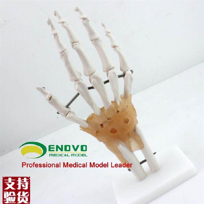 ENOVO颐诺医学人体手关节附韧带模型手J骨尺桡骨人体骨骼手足外科