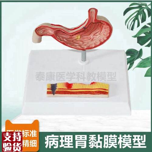 胃模型自a然大拆卸2件黏膜胃壁临床常见病理贲门幽门胃结构生物课