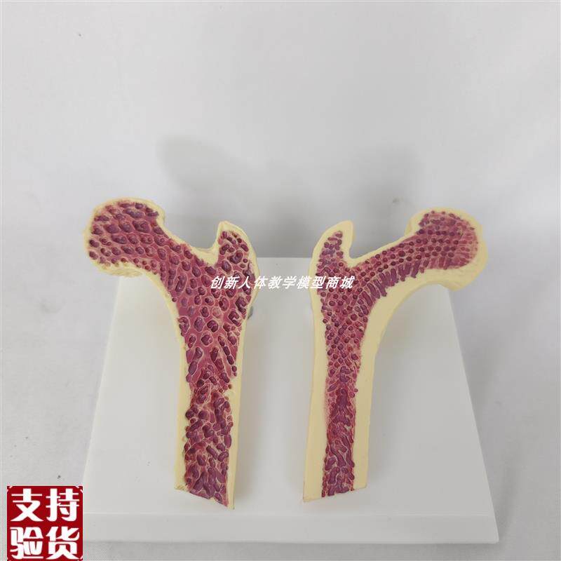 人体股骨头解剖模型骨质疏松切面解剖人类骨骼骨架V解剖医讲解教