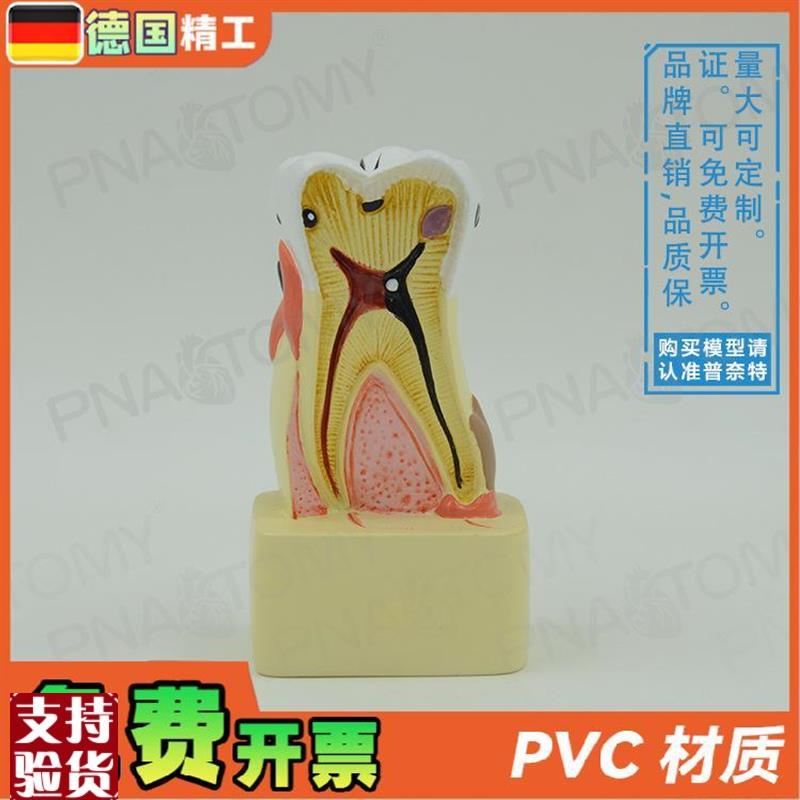德国】牙b齿模型幼儿园口腔教学玩具牙科教学口腔科病理医患沟