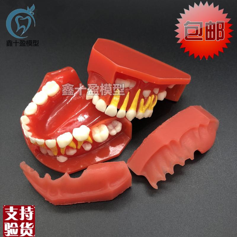 牙科齿科模型儿童乳牙替s换牙齿模型乳恒牙交替展示医患沟通7011