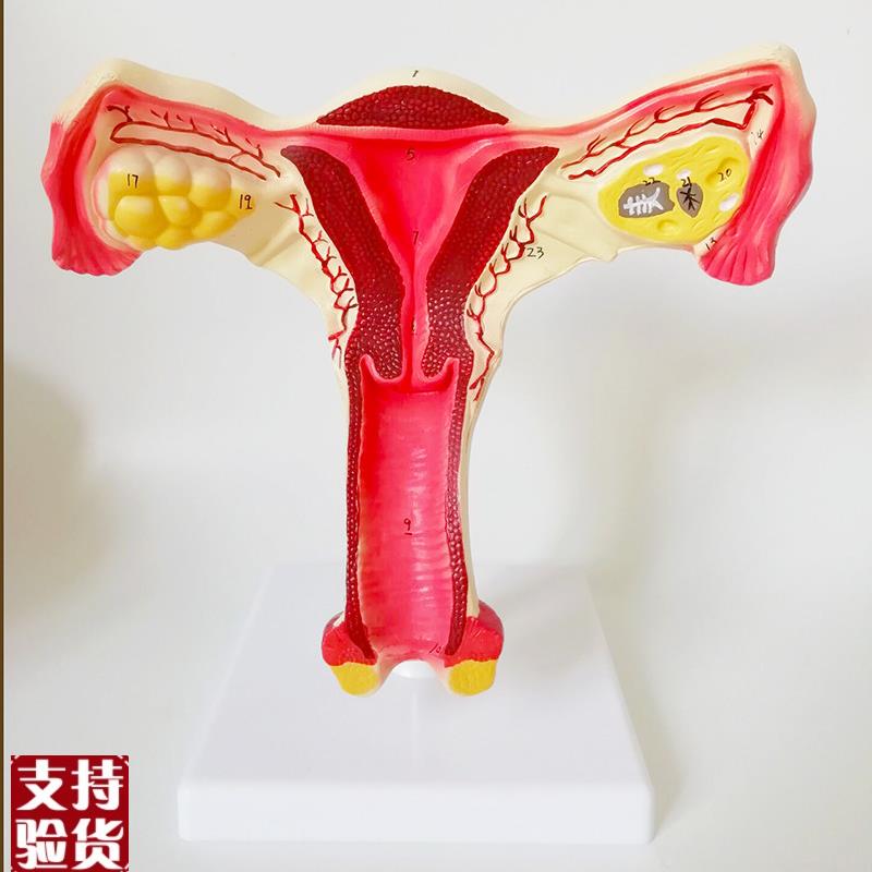 女性生殖器子宫h模型阴道卵巢教学模具病理变化产科普厂家直销包