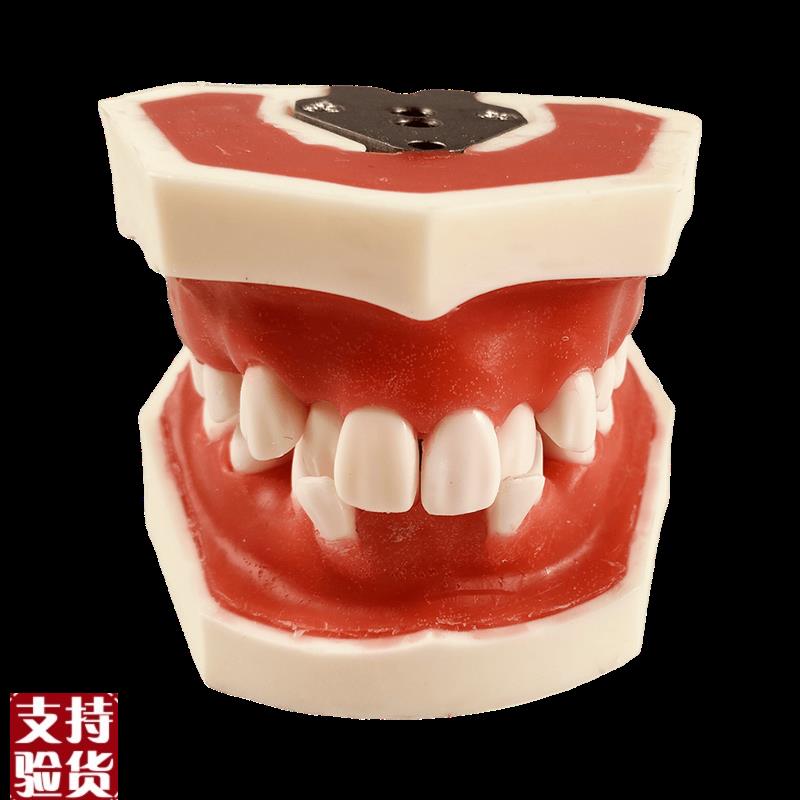 牙模型备牙牙科口腔矫正牙周模型练E习牙结石刮治软牙龈牙列不齐