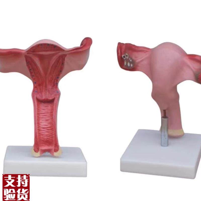子宫放大模d型阴道生殖器官卵巢输卵管剖面教学训练解剖模具