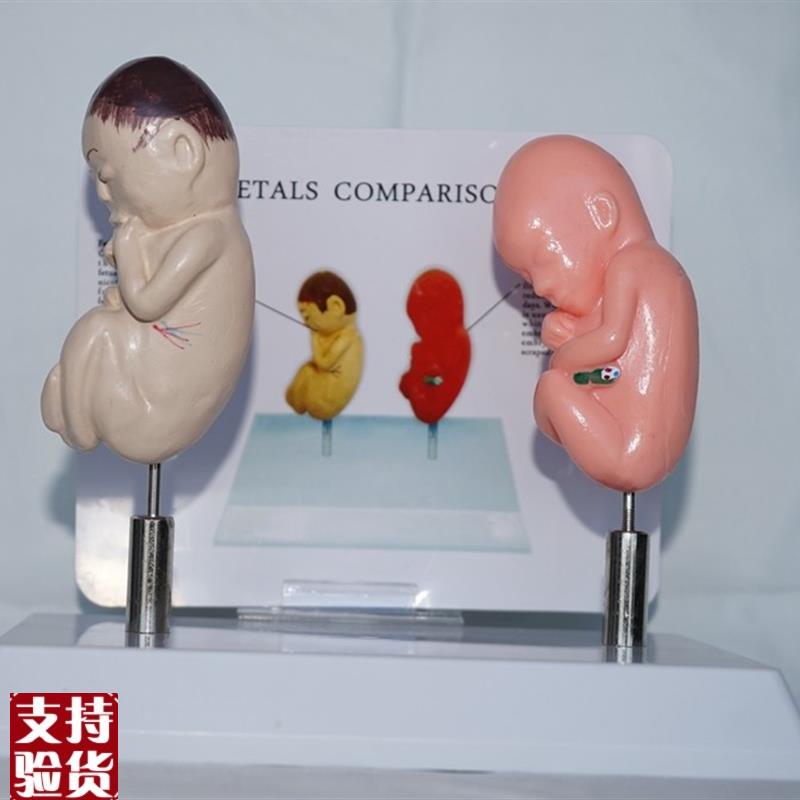 人体吸烟胎d儿与正常胎儿比较模型医用教学讲解展示
