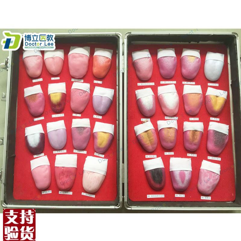 人体舌头舌苔常见病变比较模型口腔护理医用教Y学人体模型