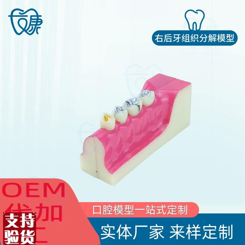 牙科口腔牙齿模型右m后牙组织分解牙模型分解口腔展示标准医患沟