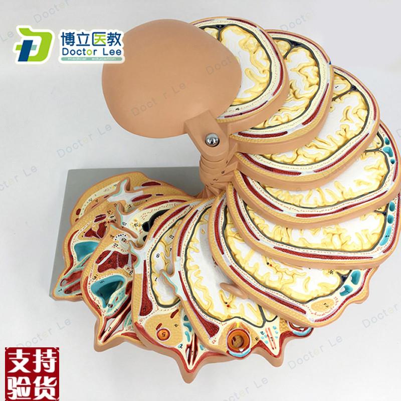 正品人体头部断层头颅脑水平切模型脑CTMRI大脑V模型影像放射学