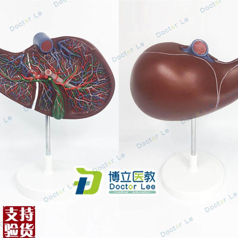 医学人体肝胆囊血管模型肝脏模型消化外肝Q胆科消化系统带血管