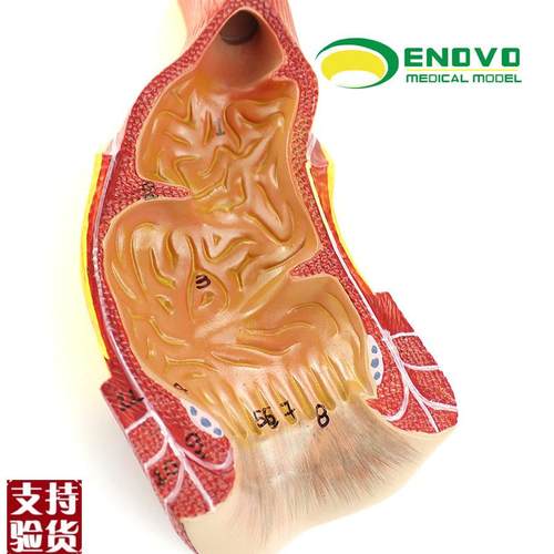 ENOVO颐诺医学人体直肠肛管肛门解剖结构模型肛V肠科外科普外科