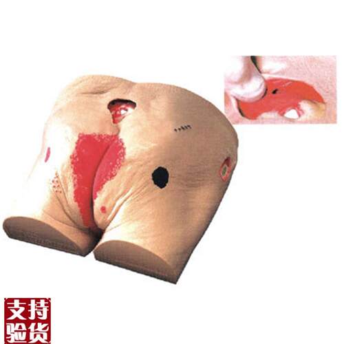 老年人褥疮(压i疮)护理模型RC-2褥疮护理练习护士模型老人褥疮