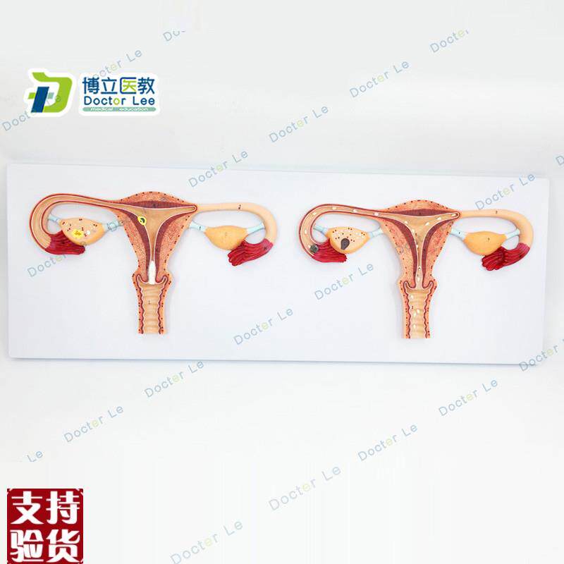 卵子受精过程放大模型女性卵子受精及卵N子发育输送及着床模型