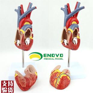 ENOVO颐诺人体心脏模型医学心血管内科心脏P介入解剖教学冠状动脉