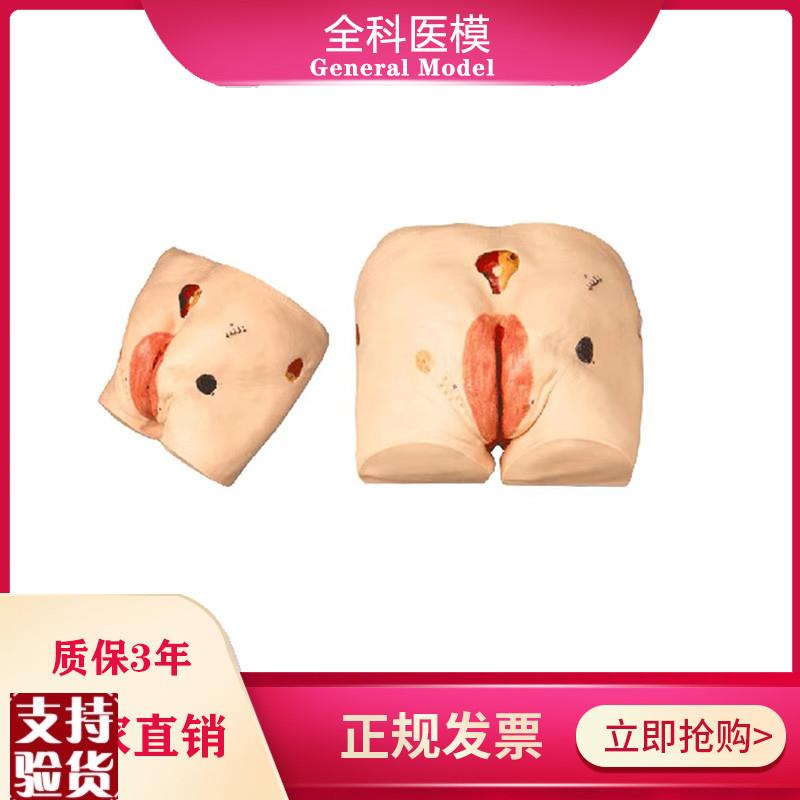 高级压疮(d褥疮)护理模型操作练习训练医学教学臀部模型