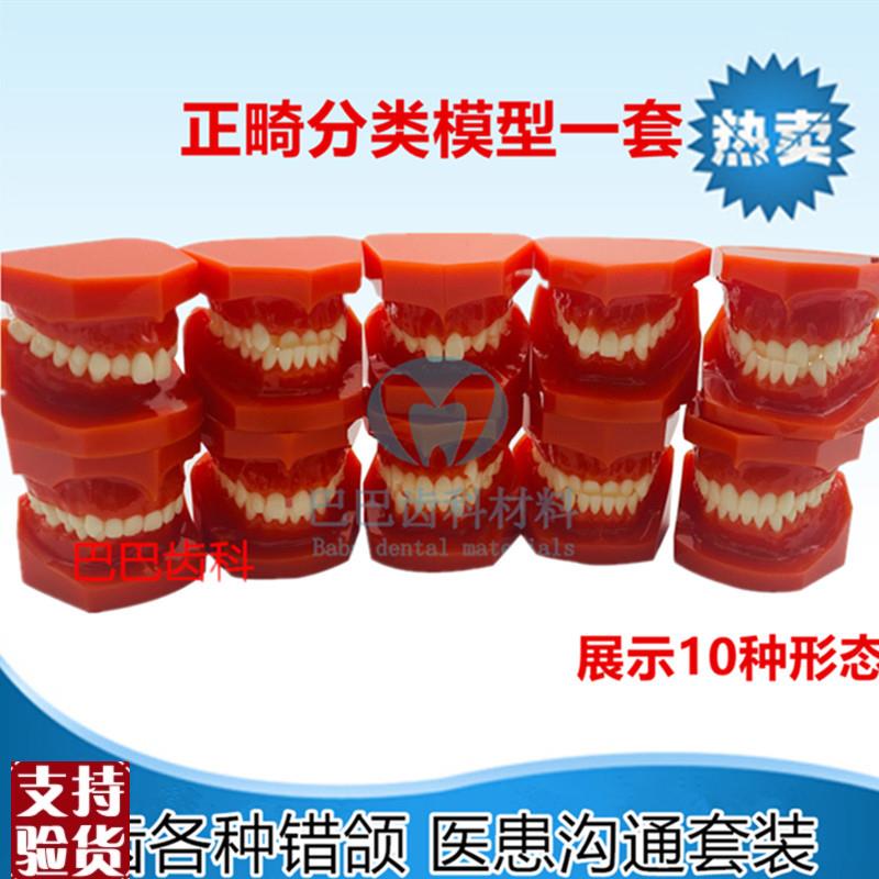 牙科正畸牙齿错颌模型地包天y天包地龅牙正畸分类展示模型一套